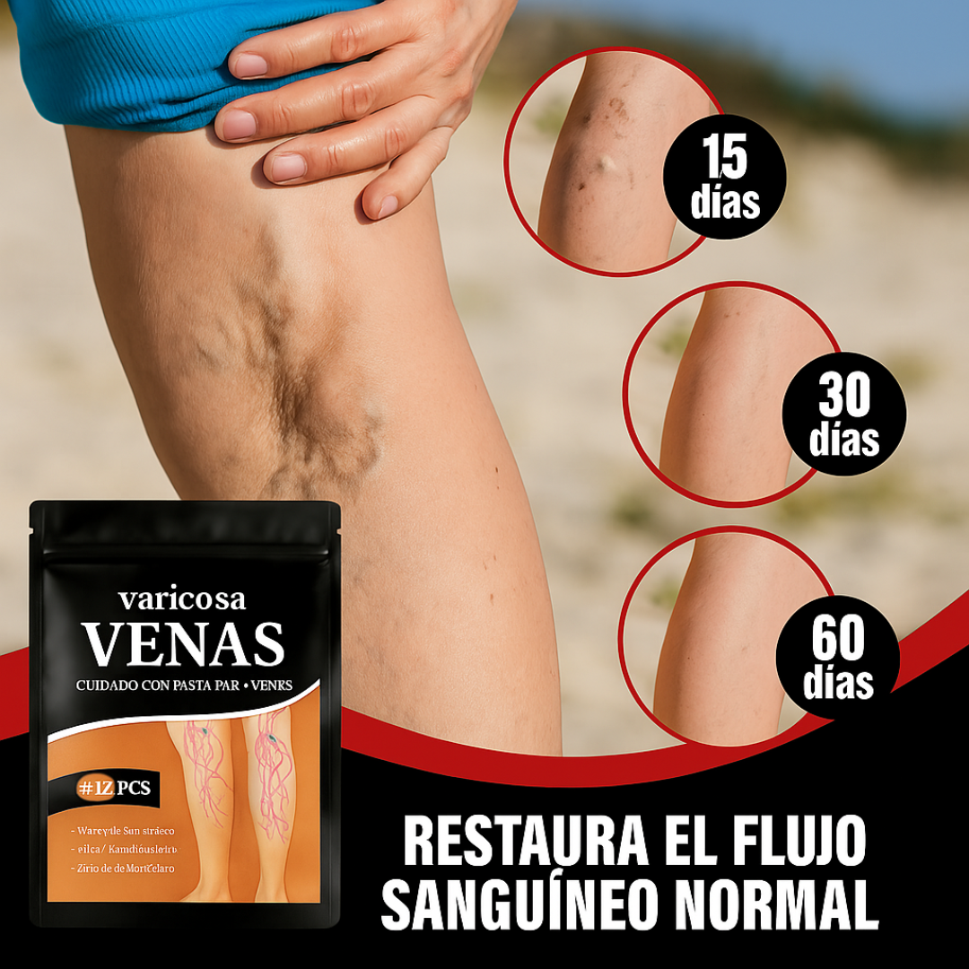 PAGUE 1 RECIBA 2 VARICOSE VEINS - SÓLO HOY