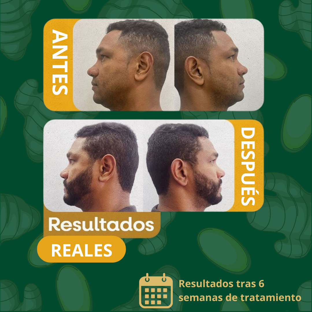¡50%! SPRAY GINGENG PARA CRECER EL PELO - SOLO HOY