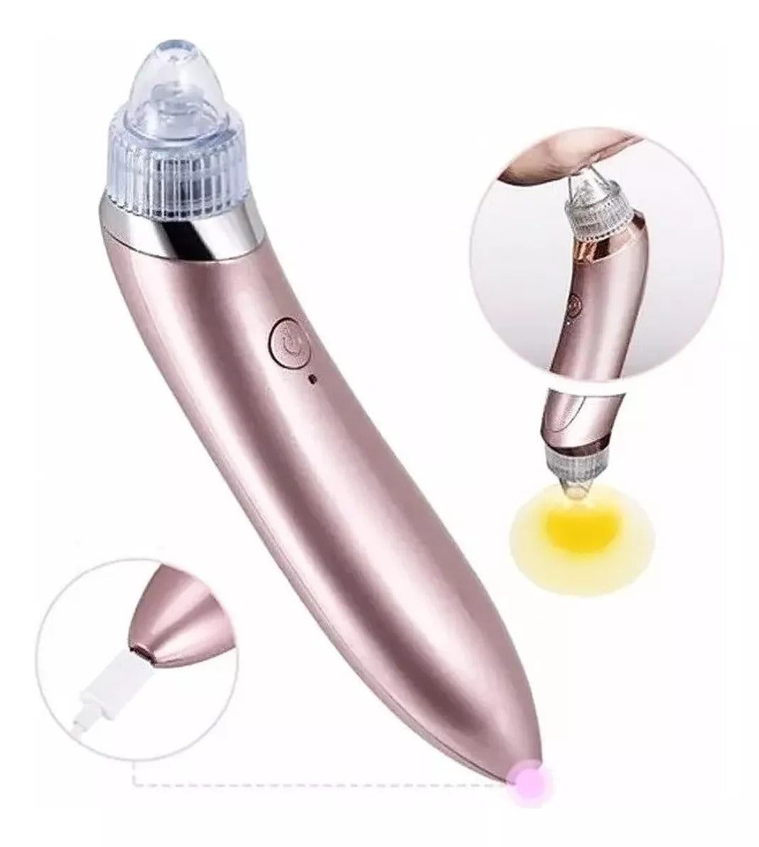 SOLO HOY 40%OFF - Extractor de espinillas electrico 5 en 1