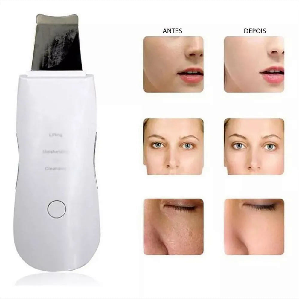 Espatula Peeling Pala Ultrasonica
