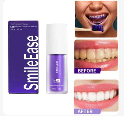 COMPRA 1 Y LLEVA 2 - Blanqueador Dental Instantáneo Hismile™ ¡QUEMA DE EXISTENCIAS!