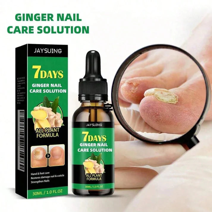 Aceite de jengibre PREMIUM para las uñas - ¡EL ÚNICO QUE LO SOLUCIONA EN 7 DÍAS!