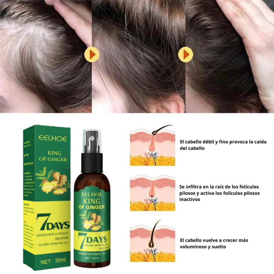 SOLO HOY - Elixir Capilar Para Crecimiento 7 Días - COMPRE 1 Y LLEVA 2
