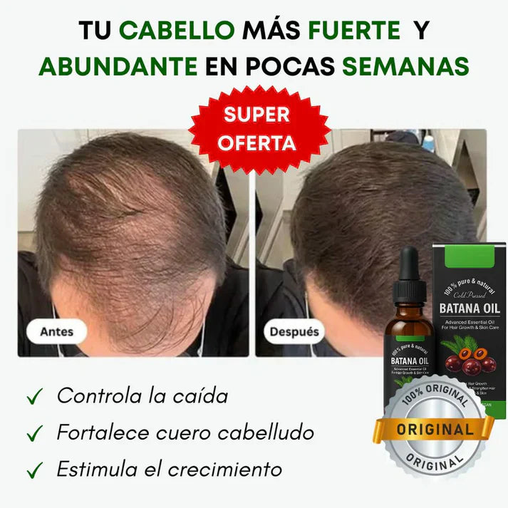 EL ÚNICO APROBADO POR EXPERTOS - Aceite de Batana