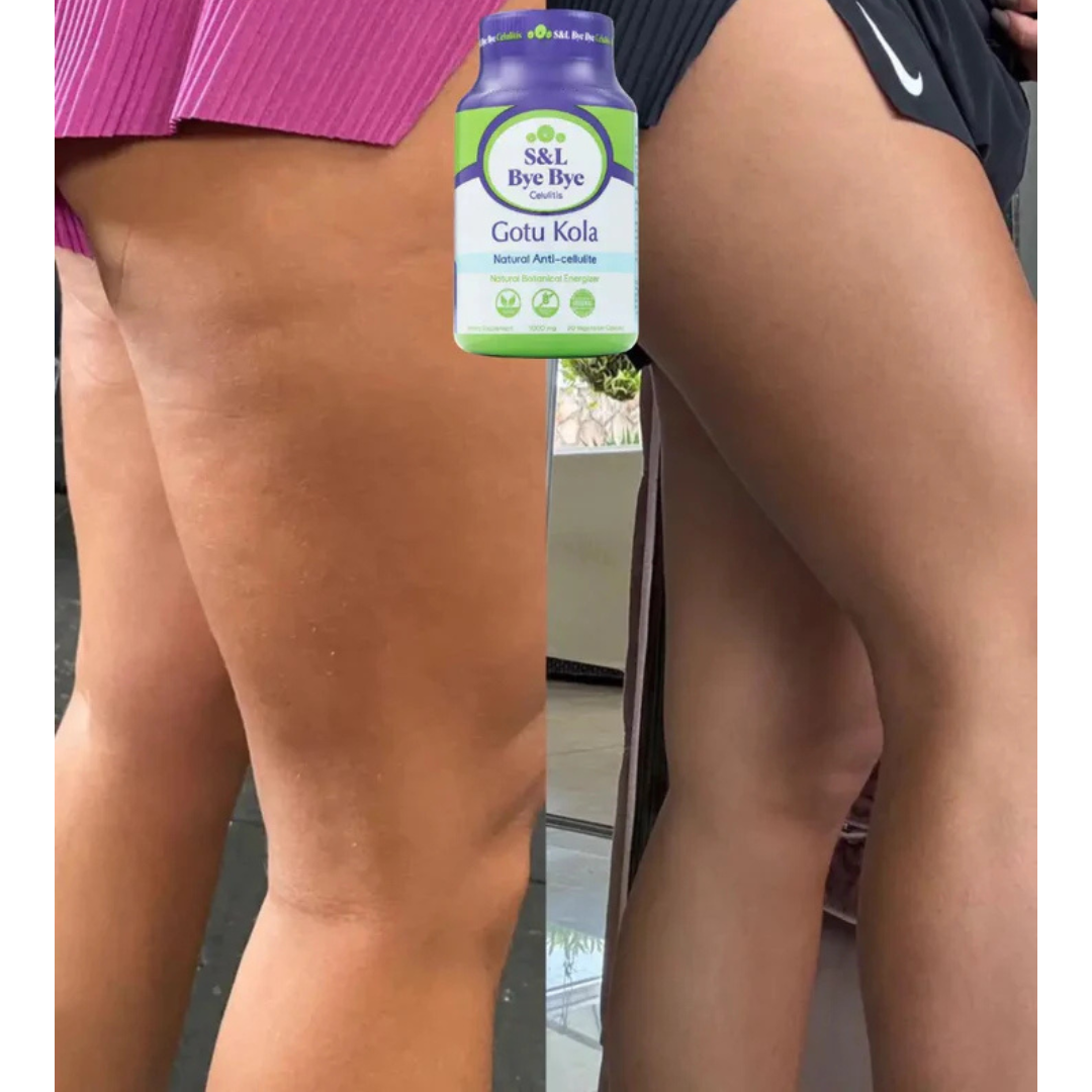 ¡Oferta Imperdible! 2 Productos para Eliminar Celulitis con 35% de Descuento - ¡Solo Hoy