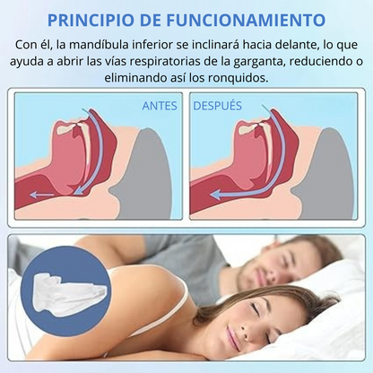 Protector Antironquido 2 en 1 - Alivio de los ronquidos + Ajuste de la mandíbula - ÚLTIMAS UNIDADES DE LA PROMO 40% OFF