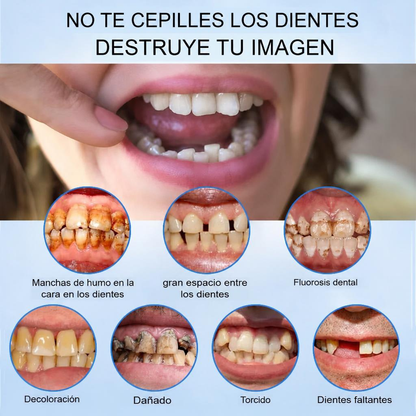 Smile Easy ComfortDent™ 🦷 Prótesis Dental de Silicona Ajustable - SOLO HOY LA SEGUNDA UNIDAD POR SOLO + $39.000 (Cópia)