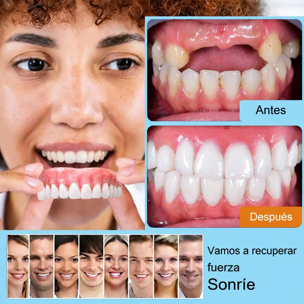 Smile Easy ComfortDent™ 🦷 Prótesis Dental de Silicona Ajustable - SOLO HOY LA SEGUNDA UNIDAD POR SOLO + $39.000