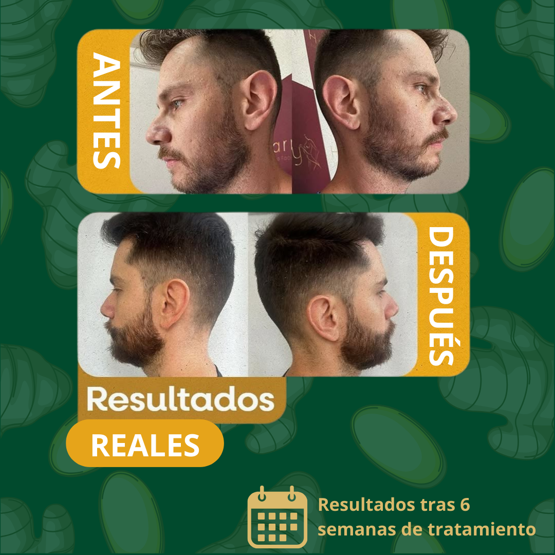 ¡50% Paga 1 y LLÉVA OTRO! SPRAY GINGENG PARA CRECER EL PELO - ÚLTIMO DÍA CON REGALO