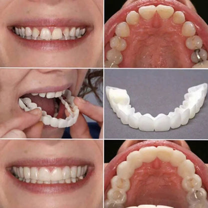 DIENTES BLANCOS E IMPECABLES AL INSTANTE - Carillas Dentales Arriba y Abajo ¡SÚPER PROMO SOLO HOY!