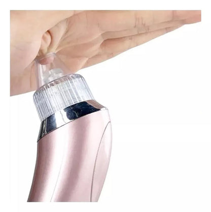 SOLO HOY 40%OFF - Extractor de espinillas electrico  5 en 1
