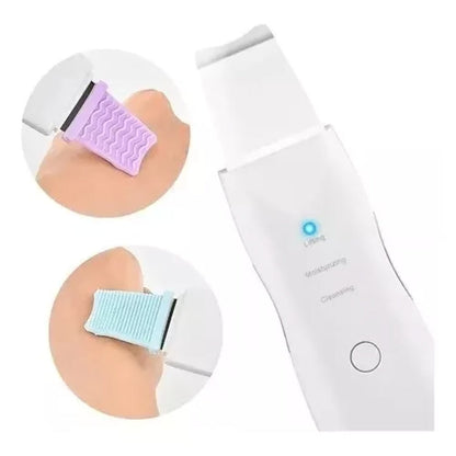 Espatula Peeling Pala Ultrasonica