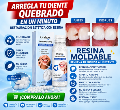 SmileKit Pro — El moldeador dental que te devuelve la confianza de sonreír en minutos